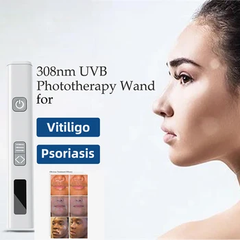 Мини-308 нм 11/33/39 Mw UV-Светотерапевтическое Устройство за Точка за Лечение на Витилиго и Псориазис Преносимо Медицинско Устройство За Грижи в дома